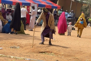 Nijerya Katarakt Ameliyatı